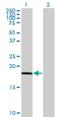 Phospholipase A And Acyltransferase 4 antibody, H00005920-M10, Novus Biologicals, Western Blot image 