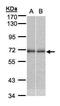 Nuclear Receptor Subfamily 2 Group C Member 2 antibody, PA5-28194, Invitrogen Antibodies, Western Blot image 