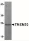 Transmembrane Protein 70 antibody, NBP1-77131, Novus Biologicals, Western Blot image 