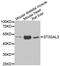 ST3 Beta-Galactoside Alpha-2,3-Sialyltransferase 3 antibody, A6753, ABclonal Technology, Western Blot image 