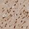 Eukaryotic Translation Initiation Factor 4 Gamma 3 antibody, NBP1-84866, Novus Biologicals, Immunohistochemistry frozen image 