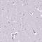 CD5 Molecule Like antibody, HPA065686, Atlas Antibodies, Immunohistochemistry paraffin image 