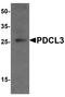 Phosducin Like 3 antibody, A10000, Boster Biological Technology, Western Blot image 