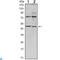 THAP Domain Containing 11 antibody, LS-C812786, Lifespan Biosciences, Western Blot image 