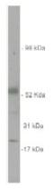 Sulfatase 2 antibody, AP05259SU-N, Origene, Western Blot image 