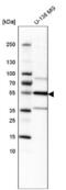 Interleukin 1 Receptor Type 1 antibody, NBP2-48500, Novus Biologicals, Western Blot image 