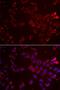 Glycine Amidinotransferase antibody, LS-C334819, Lifespan Biosciences, Immunofluorescence image 