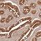 Zinc Finger Protein 776 antibody, HPA046653, Atlas Antibodies, Immunohistochemistry frozen image 