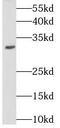 Stomatin antibody, FNab08344, FineTest, Western Blot image 