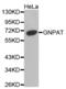 Glyceronephosphate O-Acyltransferase antibody, abx003124, Abbexa, Western Blot image 