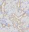 SH3 Domain Containing GRB2 Like, Endophilin B1 antibody, LS-C333536, Lifespan Biosciences, Immunohistochemistry paraffin image 
