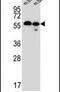 Transmembrane Protein 87B antibody, PA5-25209, Invitrogen Antibodies, Western Blot image 