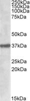 Indoleamine 2,3-Dioxygenase 2 antibody, 42-174, ProSci, Western Blot image 