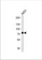 Hydroxyacyl-CoA Dehydrogenase Trifunctional Multienzyme Complex Subunit Alpha antibody, TA324876, Origene, Western Blot image 