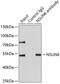 NOP2/Sun RNA Methyltransferase 6 antibody, GTX33369, GeneTex, Immunoprecipitation image 