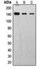 Fibroblast Growth Factor Receptor 1 antibody, orb213928, Biorbyt, Western Blot image 