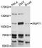 Polyribonucleotide Nucleotidyltransferase 1 antibody, abx126380, Abbexa, Western Blot image 