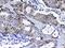 Phosphatidylinositol-4,5-Bisphosphate 3-Kinase Catalytic Subunit Beta antibody, A01091-1, Boster Biological Technology, Immunohistochemistry paraffin image 