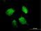 Heterogeneous Nuclear Ribonucleoprotein D antibody, H00003184-B01P, Novus Biologicals, Immunocytochemistry image 