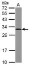 Suppressor Of Cytokine Signaling 3 antibody, PA5-28098, Invitrogen Antibodies, Western Blot image 