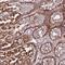 TOPAZ1 antibody, PA5-61516, Invitrogen Antibodies, Immunohistochemistry paraffin image 
