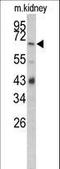 Complement Factor B antibody, LS-C168700, Lifespan Biosciences, Western Blot image 