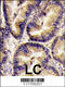 Vascular Endothelial Growth Factor B antibody, 62-228, ProSci, Immunohistochemistry paraffin image 