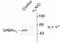 Gamma-Aminobutyric Acid Type A Receptor Alpha3 Subunit antibody, GTX31001, GeneTex, Western Blot image 