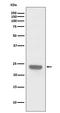 Parkinsonism Associated Deglycase antibody, M00757, Boster Biological Technology, Western Blot image 