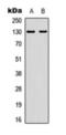 EPH Receptor A2 antibody, orb393275, Biorbyt, Western Blot image 