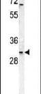 Tumor necrosis factor receptor superfamily member 6B antibody, PA5-23645, Invitrogen Antibodies, Western Blot image 