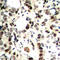 Checkpoint Kinase 2 antibody, abx133083, Abbexa, Western Blot image 