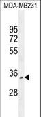 OTU Deubiquitinase 6A antibody, LS-C163294, Lifespan Biosciences, Western Blot image 