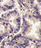 Vascular Endothelial Growth Factor C antibody, 60-979, ProSci, Immunohistochemistry paraffin image 