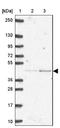 Inositol Hexakisphosphate Kinase 3 antibody, NBP2-33689, Novus Biologicals, Western Blot image 