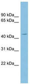 N-Terminal EF-Hand Calcium Binding Protein 3 antibody, TA344660, Origene, Western Blot image 