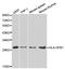 Major Histocompatibility Complex, Class II, DP Beta 1 antibody, MBS128088, MyBioSource, Western Blot image 