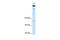 Timeless Circadian Regulator antibody, PA5-40838, Invitrogen Antibodies, Western Blot image 