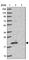 Transmembrane P24 Trafficking Protein 10 antibody, HPA050539, Atlas Antibodies, Western Blot image 