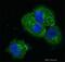 Matrix Metallopeptidase 14 antibody, ab38971, Abcam, Immunofluorescence image 