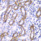 Arrestin Beta 1 antibody, LS-C746720, Lifespan Biosciences, Immunohistochemistry paraffin image 