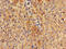 Sprouty Related EVH1 Domain Containing 1 antibody, orb53551, Biorbyt, Immunohistochemistry paraffin image 
