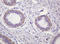 Peptidyl Arginine Deiminase 4 antibody, LS-C174035, Lifespan Biosciences, Immunohistochemistry paraffin image 