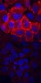 Fibroblast Growth Factor Receptor 2 antibody, AF3285, R&D Systems, Immunocytochemistry image 