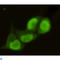 Protein Arginine Methyltransferase 6 antibody, LS-C813101, Lifespan Biosciences, Immunocytochemistry image 