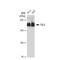 TSC Complex Subunit 2 antibody, GTX00917, GeneTex, Western Blot image 