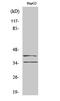 Aurora Kinase B antibody, STJ91786, St John