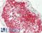 SPARC antibody, LS-C788572, Lifespan Biosciences, Immunohistochemistry paraffin image 