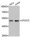 Lysophosphatidylcholine Acyltransferase 2 antibody, A4805, ABclonal Technology, Western Blot image 