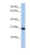 Proteasome 26S Subunit, Non-ATPase 8 antibody, NBP1-54588, Novus Biologicals, Western Blot image 
